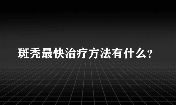 斑秃最快治疗方法有什么？