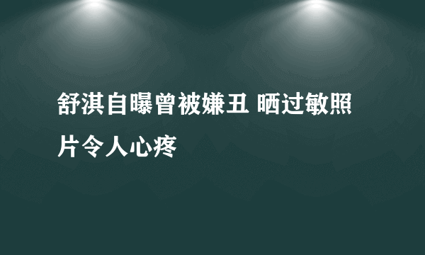 舒淇自曝曾被嫌丑 晒过敏照片令人心疼