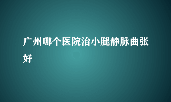 广州哪个医院治小腿静脉曲张好