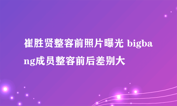 崔胜贤整容前照片曝光 bigbang成员整容前后差别大