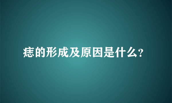 痣的形成及原因是什么？