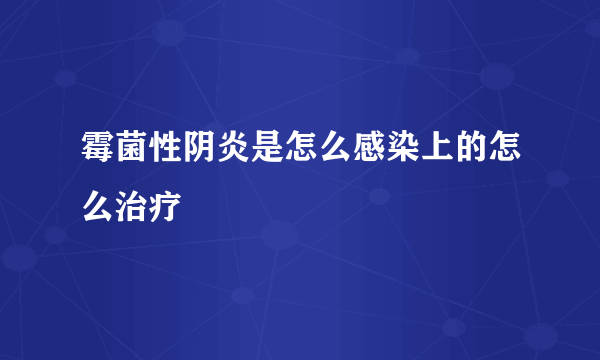 霉菌性阴炎是怎么感染上的怎么治疗