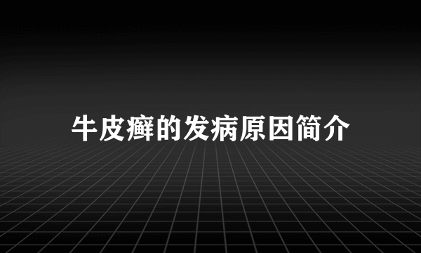 牛皮癣的发病原因简介