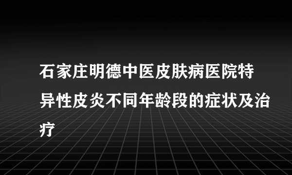 石家庄明德中医皮肤病医院特异性皮炎不同年龄段的症状及治疗