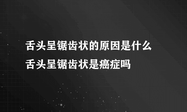 舌头呈锯齿状的原因是什么 舌头呈锯齿状是癌症吗