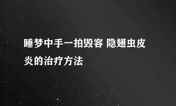 睡梦中手一拍毁容 隐翅虫皮炎的治疗方法