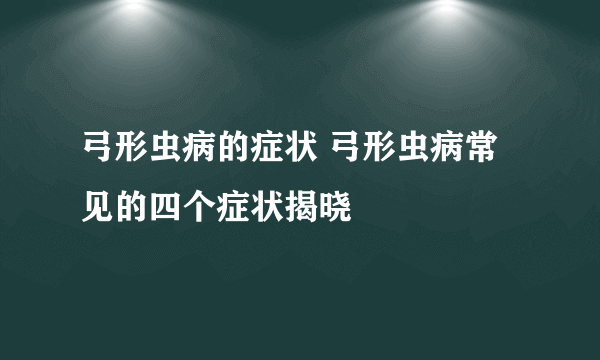 弓形虫病的症状 弓形虫病常见的四个症状揭晓