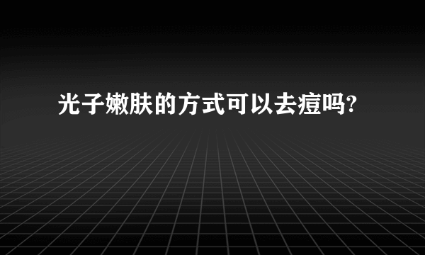 光子嫩肤的方式可以去痘吗?