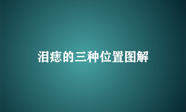 泪痣的三种位置图解