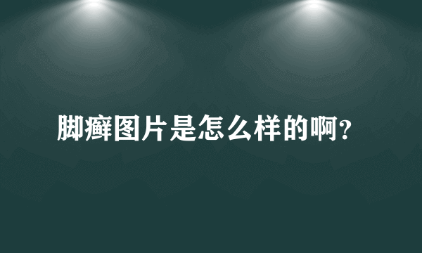 脚癣图片是怎么样的啊？