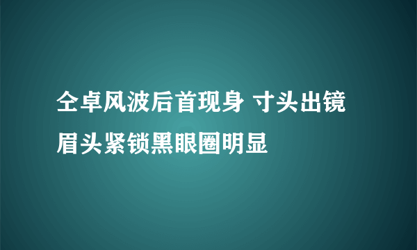 仝卓风波后首现身 寸头出镜眉头紧锁黑眼圈明显