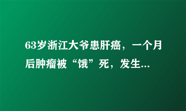 63岁浙江大爷患肝癌，一个月后肿瘤被“饿”死，发生了什么？