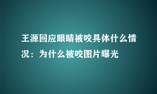 王源回应眼睛被咬具体什么情况：为什么被咬图片曝光