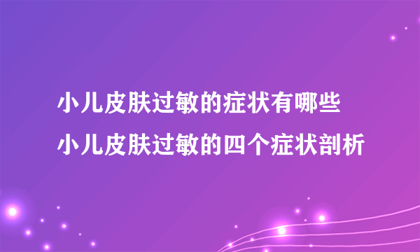 小儿皮肤过敏的症状有哪些 小儿皮肤过敏的四个症状剖析