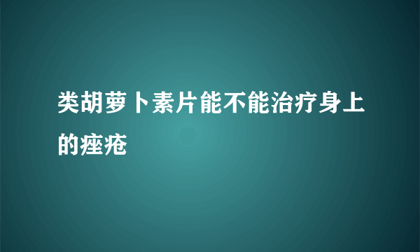 类胡萝卜素片能不能治疗身上的痤疮