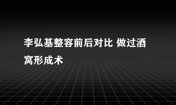 李弘基整容前后对比 做过酒窝形成术