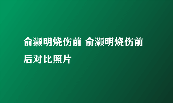 俞灏明烧伤前 俞灏明烧伤前后对比照片