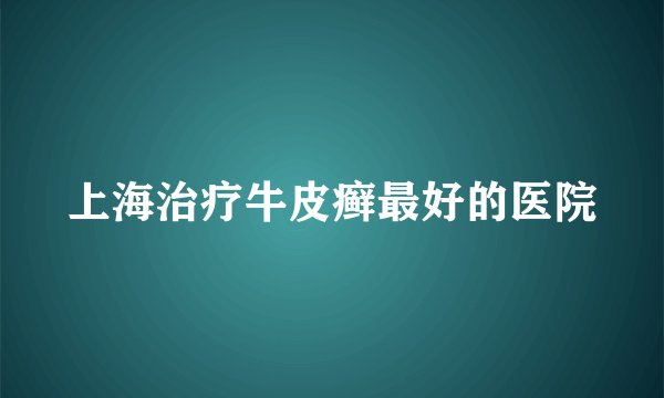 上海治疗牛皮癣最好的医院