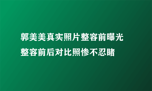 郭美美真实照片整容前曝光 整容前后对比照惨不忍睹