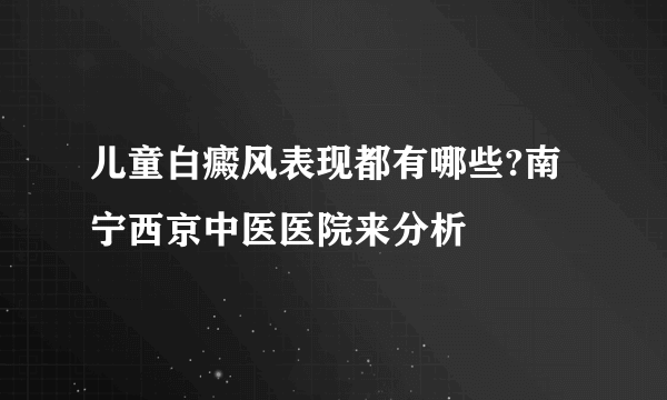 儿童白癜风表现都有哪些?南宁西京中医医院来分析