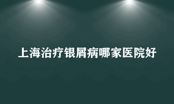 上海治疗银屑病哪家医院好