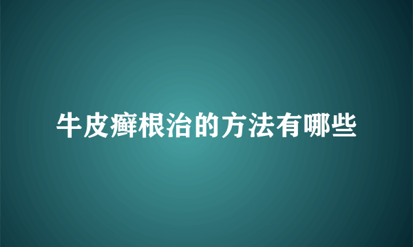 牛皮癣根治的方法有哪些