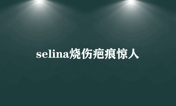 selina烧伤疤痕惊人