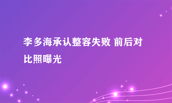 李多海承认整容失败 前后对比照曝光