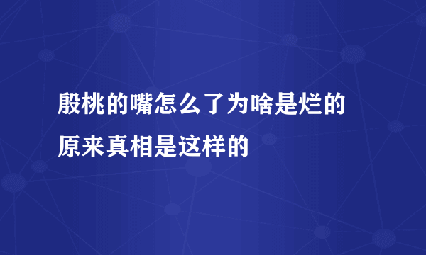 殷桃的嘴怎么了为啥是烂的 原来真相是这样的